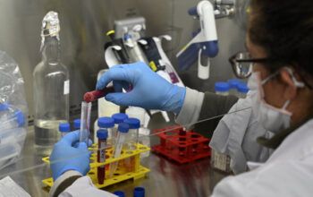 Em 2021 Fiocruz deve fabricar vacina para 130 milhões de brasileiros