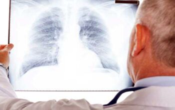 Pneumonia  ainda é a principal causa de morte de crianças no país