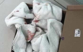 Criança de 11 meses é encontrada em lixeira por moradores do Coroado em Manaus