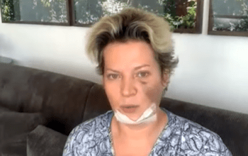 Após suposta recusa, Joice Hasselmann realiza exame toxicológico