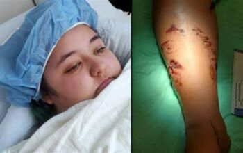 Jovem é arrastada para baixo da água após ser atacada por crocodilo