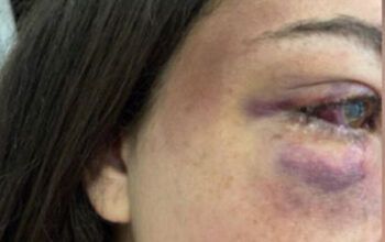 Estudante diz que foi agredida por namorado de influencer