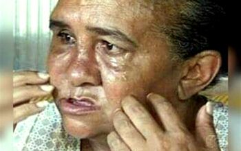 Agredida com martelo e chave de fenda, mulher pede ajuda para viver