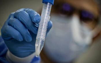 Ministério da Saúde emite alerta sobre nova variante do coronavírus identificada na África do Sul