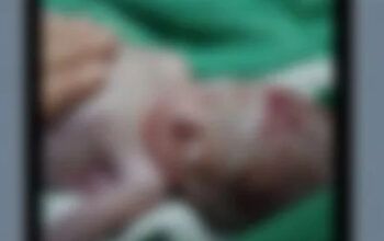 Agente funerário descobre que bebê dado como morto estava vivo