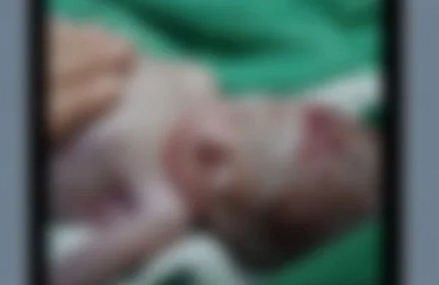 Agente funerário descobre que bebê dado como morto estava vivo