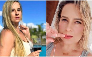 Após acidente de moto, candidata ao Miss Bumbum perde um braço