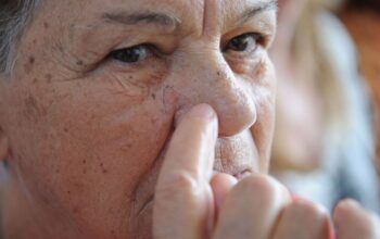 Dezembro Laranja - Brasileiros devem redobrar cuidados no verão contra câncer de pele