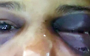 'Foram três dias e três noites de tortura' diz estudante de 23 anos que foi mantida em cárcere privado