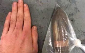 Bizarro - Homem chega ao hospital com projétil da 2º Guerra no reto