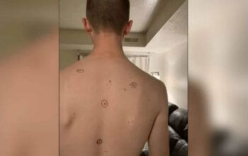 Mulher manda marido todo marcado para médica. Resposta surpreende