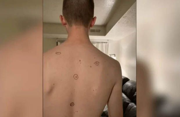 Mulher manda marido todo marcado para médica. Resposta surpreende