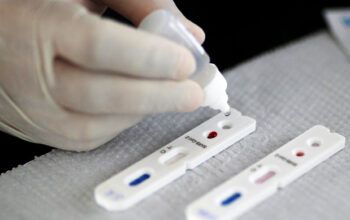 Anvisa aprova por unanimidade uso de autotestes de Covid no Brasil