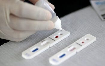 Anvisa dá 15 dias para Saúde esclarecer informações sobre autotestes