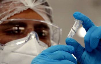 Casos de Síndrome Respiratória Aguda Grave crescem 135% no Brasil