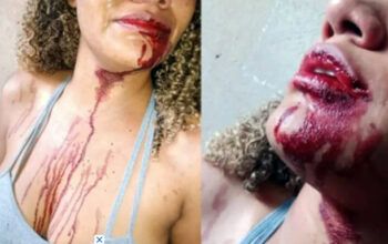 Sargento da PM dá soco na boca de mulher durante abordagem