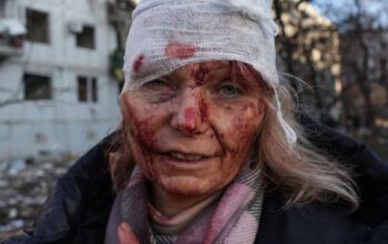 Ucrânia tem 137 mortos e 300 feridos após bombardeios da Rússia