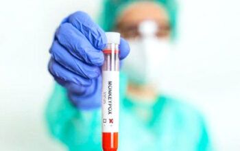 Sobe para 9 o número de casos confirmados de monkeypox no Amazonas