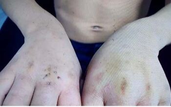 Mulher é presa suspeita de torturar criança de oito anos; ela foi denunciada por direção de escola