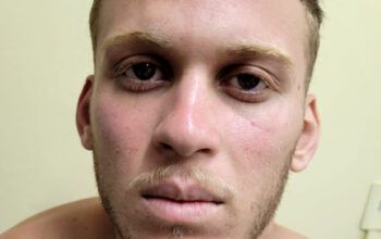 Após matar grávida e adolescente por vingança, “Cara de Velha” é preso no Iranduba