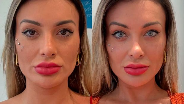 Andressa Urach reclama da mudança de cor de olho: "Não vale a pena a dor"