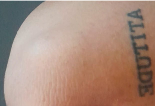 Cacau Show: “Fui marcado que nem gado”, diz ex-funcionário que fez tatuagem igual à de CEO