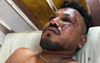 Único sobrevivente de queda do Boeing 787 na Índia conta como escapou