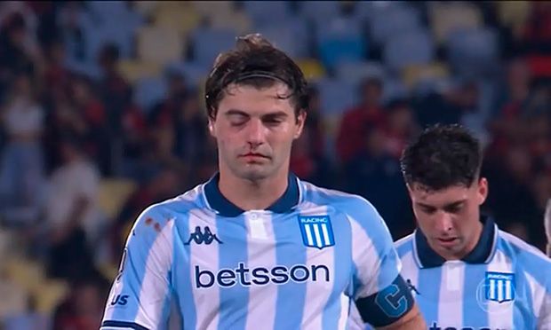 “Apanhou igual o Rocky”: argentino viraliza após sair destruído de jogo contra o Flamengo