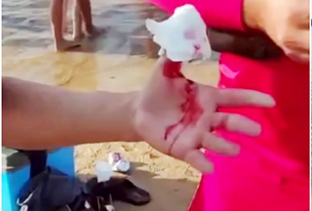 Ataque de piranha afugenta banhistas do balneário do Miriti em Manacapuru