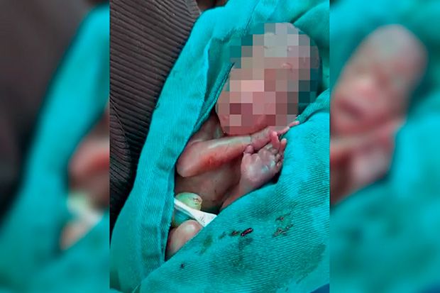 Bebê dado como morto “acorda” no velório: “chorou no caixão”: b