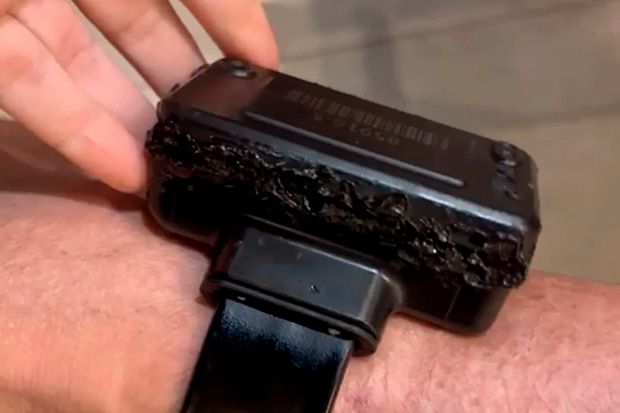 Bolsonaro confessa que queimou tornozeleira com ferro quente por curiosidade