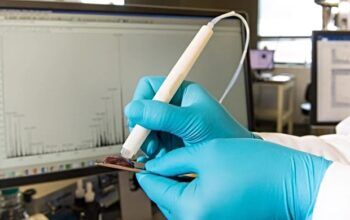 Caneta que detecta câncer em segundos é testada pela 1ª vez no Brasil