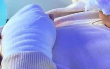 Criança brasileira tem dois dedos amputados por colegas de escola em Portugal