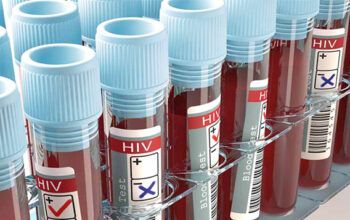 Pesquisadores descobrem anticorpo eficaz contra o HIV