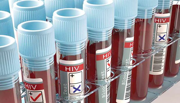 Pesquisadores descobrem anticorpo eficaz contra o HIV