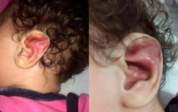 Mãe foragida por torturar e quebrar 6 costelas de filha bebê é presa