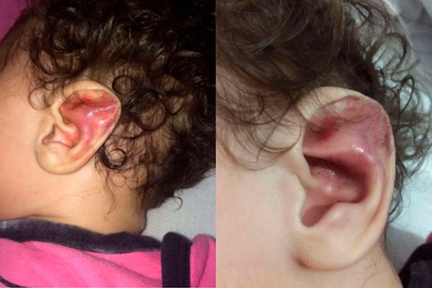 Mãe foragida por torturar e quebrar 6 costelas de filha bebê é presa