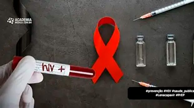 Fiocruz conduzirá estudo com injeção contra HIV em sete cidades