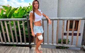 Advogada compartilha relato sobre mordida por um tubarão-lixa: “grudou na minha perna”