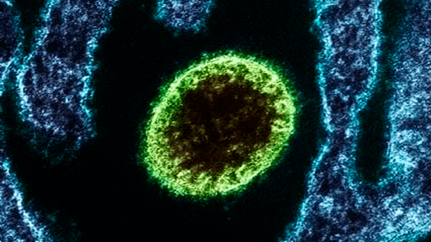 Novo surto de vírus letal preocupa autoridades