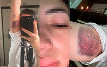 Mulher espancada em carro de app é ameaçada de morte: “Vai pro saco”