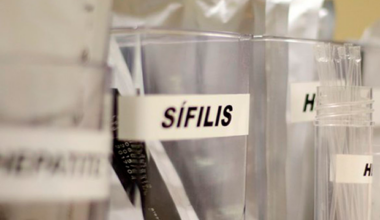 SUS passa a adotar antibiótico para prevenir sífilis e clamídia