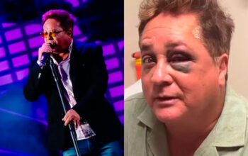 Leonardo esconde olho roxo e faz show de óculos escuros após acidente