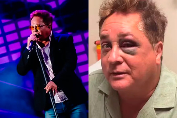 Leonardo esconde olho roxo e faz show de óculos escuros após acidente