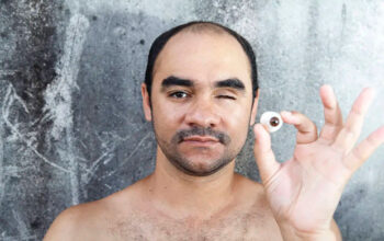 STF manda SP indenizar fotógrafo que perdeu visão após tiro da PM