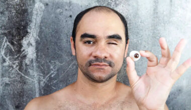 STF manda SP indenizar fotógrafo que perdeu visão após tiro da PM