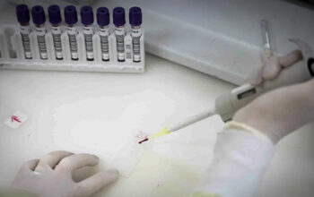 Exames descartam ebola em imigrante da República Democrática do Congo