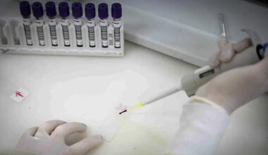 Exames descartam ebola em imigrante da República Democrática do Congo