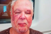 Petista de 69 anos é espancado em frente de casa no Rio por motivação política