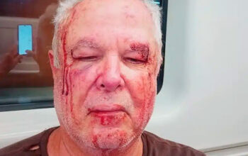 Petista de 69 anos é espancado em frente de casa no Rio por motivação política